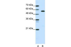 WB Suggested Anti-CORO1A Antibody Titration:  0. (Coronin 1a 抗体  (Middle Region))