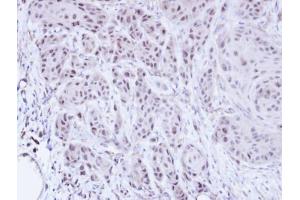 IHC-P Image Immunohistochemical analysis of paraffin-embedded Cal27 xenograft, using SCMH1, antibody at 1:100 dilution. (SCMH1 抗体  (Center))