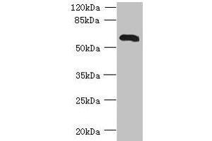 Western blot All lanes: USP30 antibody at 7 μg/mL + Mouse liver tissue Secondary Goat polyclonal to rabbit IgG at 1/10000 dilution Predicted band size: 59 kDa Observed band size: 59 kDa (USP3 抗体  (C-Term))
