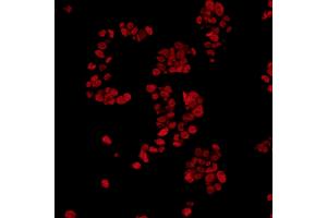 Immunofluorescence (IF) image for anti-Fused in Sarcoma (FUS) (AA 1-50) antibody (ABIN7454040) (Recombinant FUS 抗体  (AA 1-50))