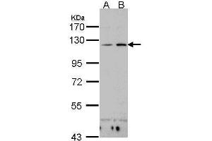 WB Image Sample(30 ug whole cell lysate) A:H1299 B:Hep G2 , 7. (CD11c 抗体  (N-Term))