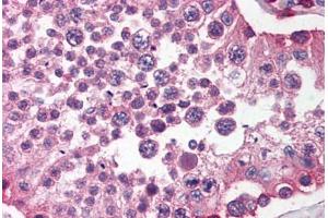 Human Testis (formalin-fixed, paraffin-embedded) stained with SIRPA antibody ABIN214476 at 2. (SIRPA 抗体  (C-Term))
