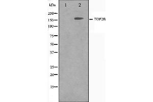 Western blot analysis on Jurkat cell lysate using TOP2B Antibody.