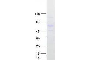 Western Blotting (WB) image for Peroxisome Proliferator-Activated Receptor delta (PPARD) (Transcript Variant 1) protein (Myc-DYKDDDDK Tag) (ABIN2729419)