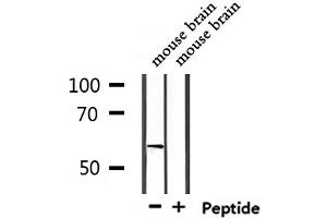 Western blot analysis of extracts from mouse brain, using USP17L Antibody. (USP17L9P 抗体)