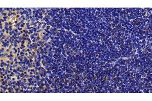 Immunohistochemistry (IHC) image for anti-Mitogen-Activated Protein Kinase Kinase 7 (MAP2K7) (AA 113-388) antibody (ABIN7439396)