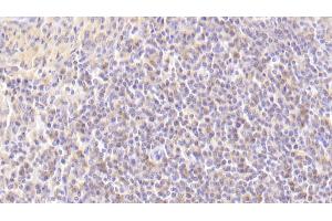 Detection of MAP2K7 in Human Spleen Tissue using Polyclonal Antibody to Mitogen Activated Protein Kinase Kinase 7 (MAP2K7) (MAP2K7 抗体  (AA 113-388))