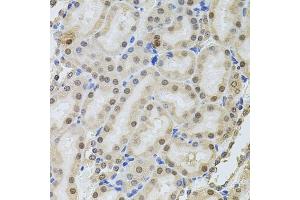 Immunohistochemistry of paraffin-embedded rat kidney using POP4 antibody (ABIN6128482, ABIN6145964, ABIN6145966 and ABIN6220640) at dilution of 1:100 (40x lens). (RPP29 抗体  (AA 1-220))