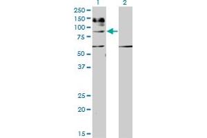 Western Blotting (WB) image for anti-Interleukin 31 Receptor A (IL31RA) (AA 21-121) antibody (ABIN599325) (IL31RA 抗体  (AA 21-121))