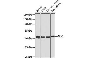 Western blot analysis of extracts of various cell lines, using TLX1 antibody (ABIN6131789, ABIN6149229, ABIN6149230 and ABIN6216643) at 1:3000 dilution. (TLX1 抗体  (AA 1-190))