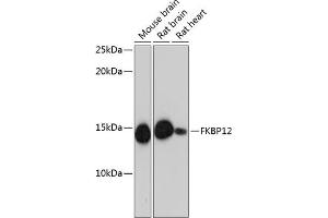Western blot analysis of extracts of various cell lines, using FKBP12 Rabbit mAb (ABIN7267211) at 1:1000 dilution. (FKBP1A 抗体)