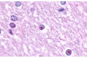 Image no. 1 for anti-Lysophosphatidic Acid Receptor 1 (LPAR1) (N-Term) antibody (ABIN1048529) (LPAR1 抗体  (N-Term))