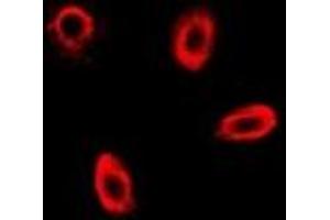 Immunofluorescent analysis of FBP1 staining in MCF7 cells. (FBP1 抗体)