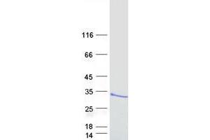 Western Blotting (WB) image for ADP-Ribosylation Factor-Like 14 (ARL14) protein (Myc-DYKDDDDK Tag) (ABIN2714906)