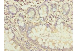 Immunohistochemistry of paraffin-embedded human small intestine tissue using ABIN7165370 at dilution of 1:100 (FAM118B 抗体  (AA 83-351))
