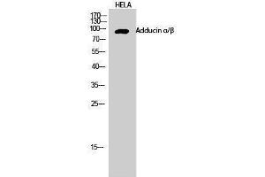 Western Blotting (WB) image for anti-Adducin alpha/beta (Lys5) antibody (ABIN3183186) (Adducin alpha/beta (Lys5) 抗体)