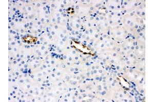 Immunohistochemistry (IHC) image for anti-Solute Carrier Family 2 (Facilitated Glucose Transporter) Member 8 (SLC2A8) (AA 461-477), (C-Term) antibody (ABIN3043992)