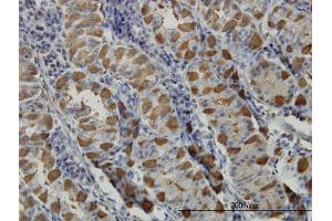 Immunostaining (ISt) image for anti-Golgi-Associated, gamma Adaptin Ear Containing, ARF Binding Protein 1 (GGA1) (AA 1-89) antibody (ABIN565221)