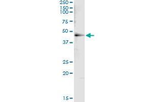 Immunoprecipitation of HDAC8 transfected lysate using anti-HDAC8 monoclonal antibody and Protein A Magnetic Bead , and immunoblotted with HDAC8 MaxPab rabbit polyclonal antibody. (HDAC8 抗体  (AA 1-100))