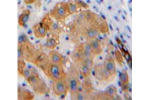 IHC-P analysis of Liver tissue, with DAB staining. (Hexosaminidase A 抗体  (AA 319-528))