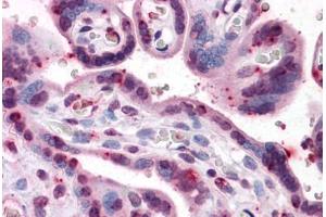 Human Placenta: Formalin-Fixed, Paraffin-Embedded (FFPE)