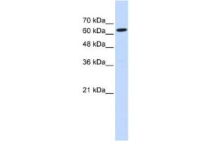 WB Suggested Anti-LGTN Antibody Titration:  0. (EIF2D 抗体  (Middle Region))