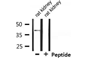Western blot analysis of extracts from rat kidney, using CCRL1 Antibody. (CCRL1 抗体  (C-Term))