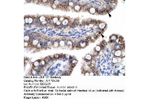 Human Intestine (Zinc Finger with KRAB and SCAN Domains 7 (ZKSCAN7) (N-Term) 抗体)