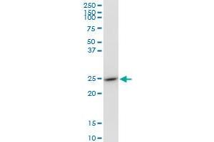 Western Blotting (WB) image for anti-Glutathione S-Transferase omega 1 (GSTO1) (AA 1-241) antibody (ABIN522902)