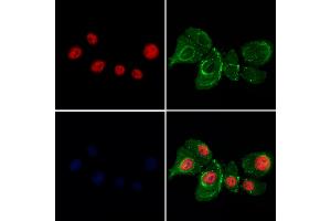 ABIN7094087 and ABIN7098131 staining Hela cells by IF/ICC. (BANP 抗体  (C-Term))