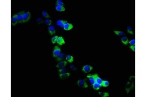 Immunofluorescence staining of PC3 cells with ABIN7167972 at 1:133, counter-stained with DAPI. (ARHGEF18 抗体  (AA 159-551))