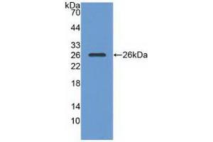 Western blot analysis of recombinant Human RASA1. (RASA1 抗体  (AA 403-596))