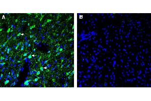 Expression of 5HT6 in in rat dorsal raphe nucleus (DRN).