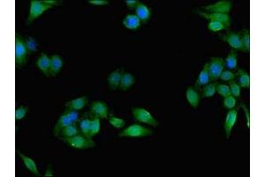 Immunofluorescent analysis of HepG2 cells using ABIN7158476 at dilution of 1:100 and Alexa Fluor 488-congugated AffiniPure Goat Anti-Rabbit IgG(H+L) (CES1 抗体  (AA 291-566))