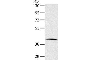 Western Blotting (WB) image for anti-Cyclin-Dependent Kinase 10 (CDK10) antibody (ABIN2421367) (CDK10 抗体)