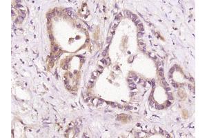 Immunohistochemistry (Paraffin-embedded Sections) (IHC (p)) image for anti-Protein Tyrosine Phosphatase, Non Receptor Type 23 (PTPN23) (AA 1501-1636) antibody (ABIN1714283)