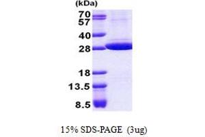 SDS-PAGE (SDS) image for Stomatin (STOM) (AA 55-288) protein (His tag) (ABIN5853047)