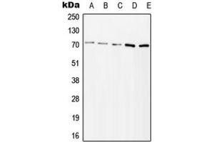 Western blot analysis of ZAP70 (pY315) expression in Jurkat H2O2-treated (A), HeLa H2O2-treated (B), Ramos lambda phosphatase-treated (C), mouse kidney (D), rat kidney (E) whole cell lysates. (ZAP70 抗体  (pTyr315))