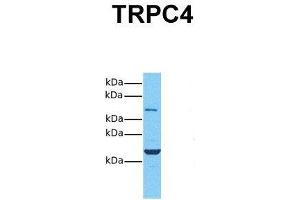 Host:  Rabbit  Target Name:  TRPC4  Sample Tissue:  Human 293T  Antibody Dilution:  1. (TRPC4 抗体  (Middle Region))