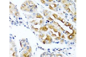 Immunohistochemistry of paraffin-embedded Human stomach using CCL21 Polyclonal Antibody at dilution of 1:100 (40x lens). (CCL21 抗体)