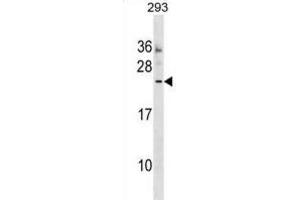 Western Blotting (WB) image for anti-Motile Sperm Domain Containing 3 (MOSPD3) antibody (ABIN2999651) (MOSPD3 抗体)