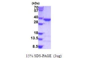 Coatomer Protein Complex, Subunit epsilon (COPE) (AA 1-308) protein (His tag)