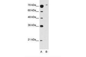 Image no. 2 for anti-Solute Carrier Family 7 (Cationic Amino Acid Transporter, Y+ System), Member 14 (SLC7A14) (AA 131-180) antibody (ABIN396880) (SLC7A14 抗体  (AA 131-180))