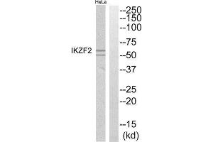 Western Blotting (WB) image for anti-IKAROS Family Zinc Finger 2 (IKZF2) (Internal Region) antibody (ABIN1852462) (IKZF2 抗体  (Internal Region))