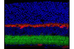 Immunohistochemistry (IHC) image for anti-gamma-aminobutyric Acid (GABA) A Receptor, beta 3 (GABRB3) (Cytoplasmic Loop) antibody (ABIN6658225)