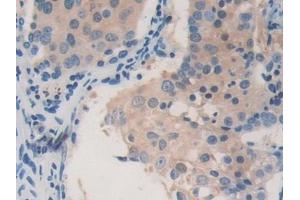 Immunohistochemistry (IHC) image for anti-Acetyl-CoA Acetyltransferase 2 (ACAT2) (AA 1-397) antibody (ABIN7435556)