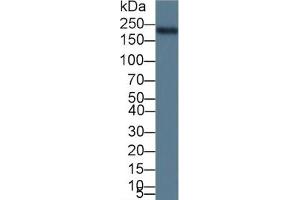Rabbit Detection antibody from the kit in WB with Positive Control: Sample Rat heart lysate. (MYH6 ELISA 试剂盒)