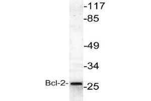 Image no. 1 for anti-B-Cell CLL/lymphoma 2 (BCL2) antibody (ABIN265326) (Bcl-2 抗体)