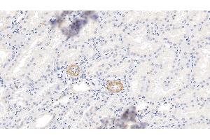 Detection of MYH11 in Human Kidney Tissue using Polyclonal Antibody to Myosin Heavy Chain 11, Smooth Muscle (MYH11) (MYH11 抗体  (AA 162-315))
