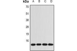 Western blot analysis of BDNF expression in A549 (A), SW480 (B), mouse kidney (C), rat brain (D) whole cell lysates. (BDNF 抗体)